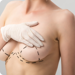 liposuction breast lift 11 1200x900 1 - Procedures