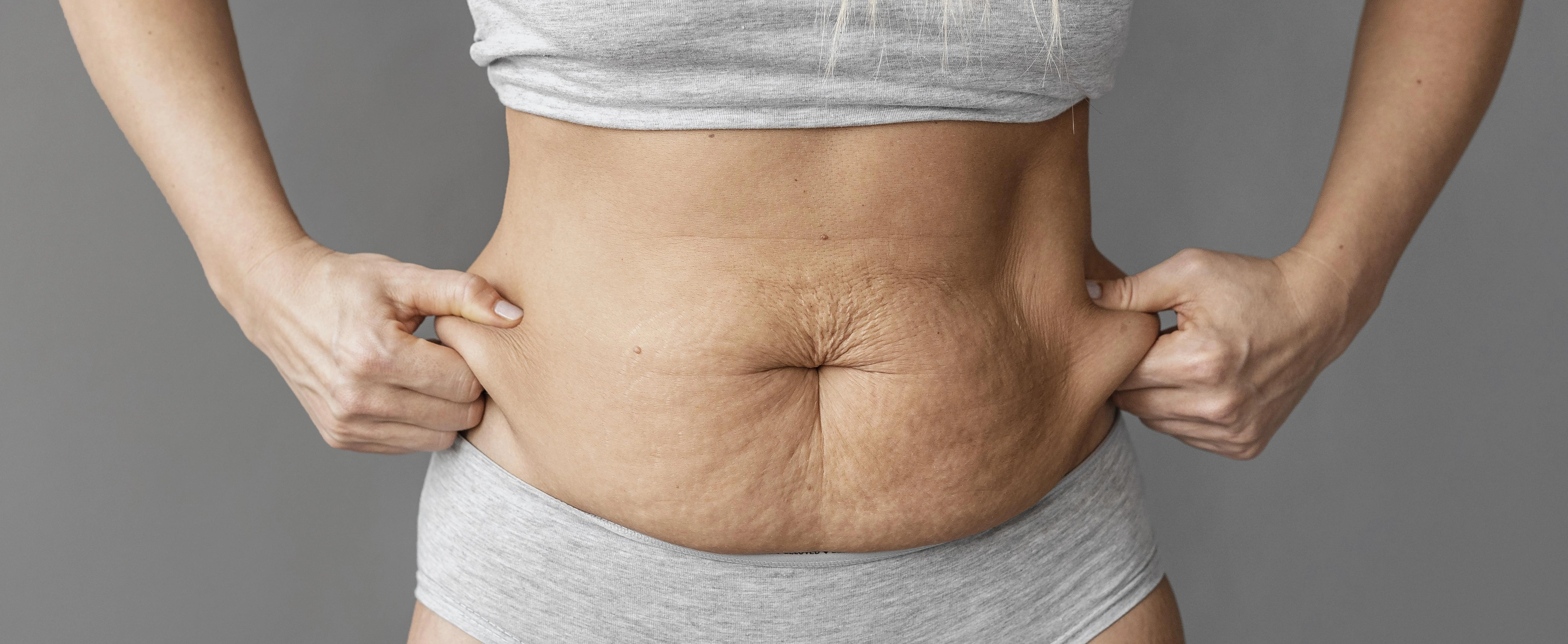 close up woman holding belly - Abdominoplasty