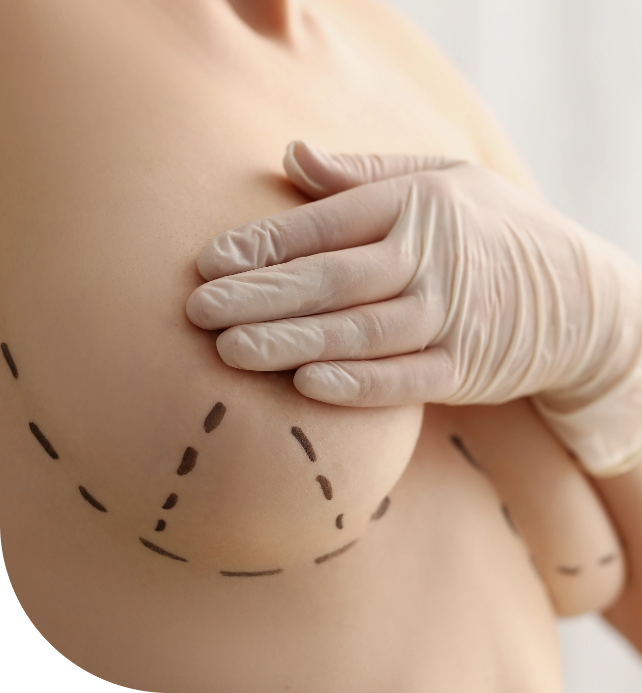 lines dots womans - Breast Augmentation